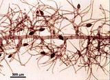 6 - Tetrasporofito con stichidi